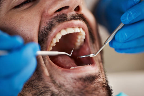 Best Pediatric Emergency Dentist in Bellevue, IA