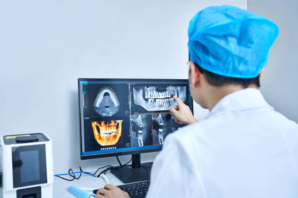 Best Emergency Treatment for Dental Infections or Abscesses in Bellevue, IA