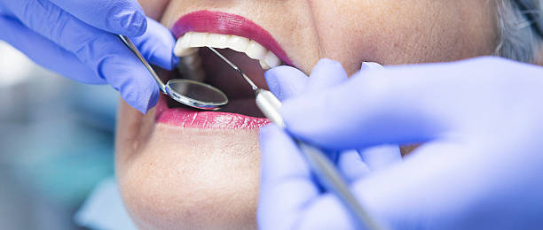 Best Emergency Dental Care for Broken or Chipped Teeth in Bellevue, IA